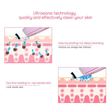 Load image into Gallery viewer, Délier Ultrasonic Skin Scrubber